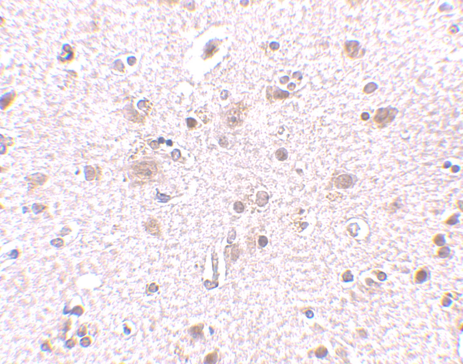 Immunohistochemistry of BRCC45 in human brain tissue with BRCC45 antibody at 2.5 μg/mL. Immunohistochemistry of BRCC45 in human brain tissue with BRCC45 antibody at 2.5 μg/mL.