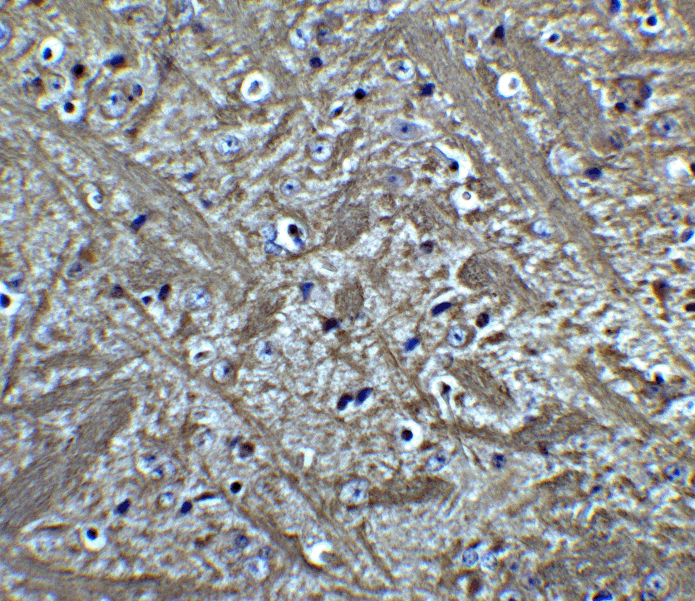 <strong>Figure 6 Immunohistochemistry Validation of Bcl-2 in Mouse Brain Tissue </strong><br>
Immunohistochemical analysis of paraffin-embedded Mouse Brain Tissue using anti-Bcl-2 antibody (3335) at 5 μg/ml. Tissue was fixed with formaldehyde and blocked with 10% serum for 1 h at RT; antigen retrieval was by heat mediation with a citrate buffer (pH6). Samples were incubated with primary antibody overnight at 4˚C. A goat anti-rabbit IgG H&L (HRP) at 1/250 was used as secondary. Counter stained with Hematoxylin. <strong>Figure 6 Immunohistochemistry Validation of Bcl-2 in Mouse Brain Tissue </strong><br>
Immunohistochemical analysis of paraffin-embedded Mouse Brain Tissue using anti-Bcl-2 antibody (3335) at 5 μg/ml. Tissue was fixed with formaldehyde and blocked with 10% serum for 1 h at RT; antigen retrieval was by heat mediation with a citrate buffer (pH6). Samples were incubated with primary antibody overnight at 4˚C. A goat anti-rabbit IgG H&L (HRP) at 1/250 was used as secondary. Counter stained with Hematoxylin.