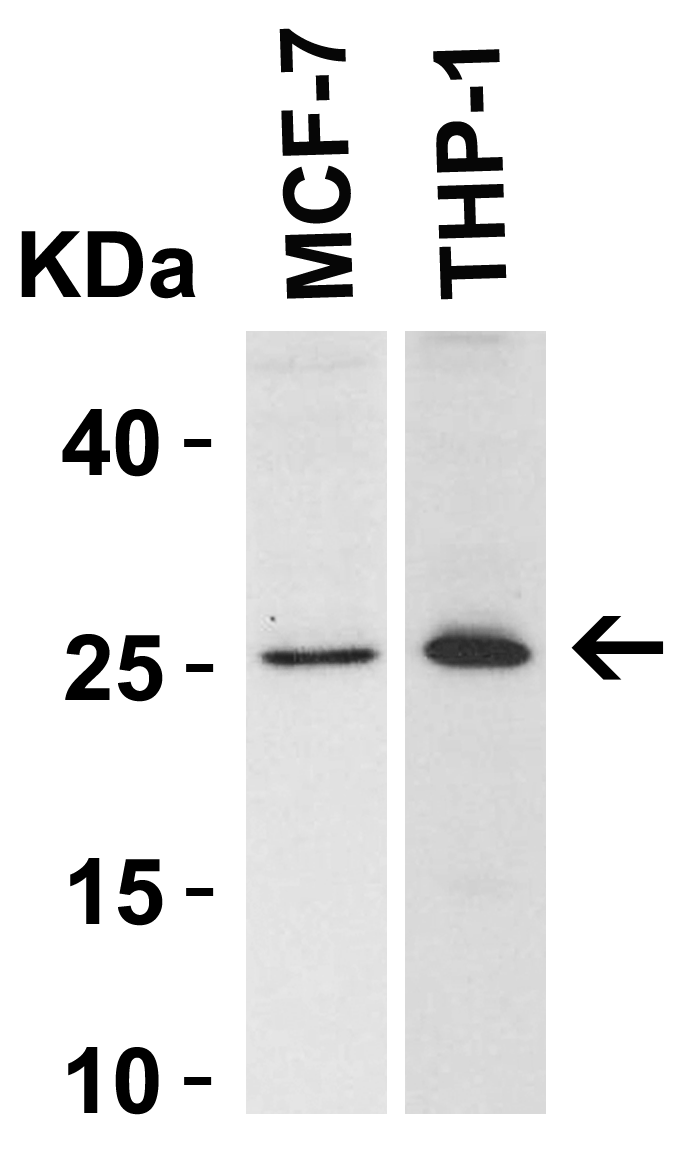 <strong>Figure 3 Western Blot Validation in Human Cell Lines</strong><br>
Loading: 15 μg of lysates per lane.
Antibodies: Bcl-2 3335, (2 μg/mL), 1h incubation at RT in 5% NFDM/TBST.
Secondary: Goat anti-rabbit IgG HRP conjugate at 1:10000 dilution. <strong>Figure 3 Western Blot Validation in Human Cell Lines</strong><br>
Loading: 15 μg of lysates per lane.
Antibodies: Bcl-2 3335, (2 μg/mL), 1h incubation at RT in 5% NFDM/TBST.
Secondary: Goat anti-rabbit IgG HRP conjugate at 1:10000 dilution.