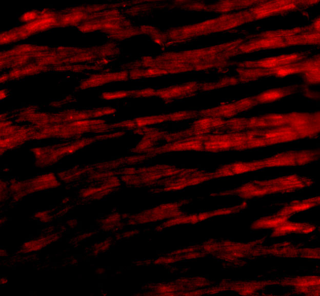 Immunofluorescence of Bcl-rambo in Human Heart cells with Bcl-rambo antibody at 20 μg/mL. Immunofluorescence of Bcl-rambo in Human Heart cells with Bcl-rambo antibody at 20 μg/mL.