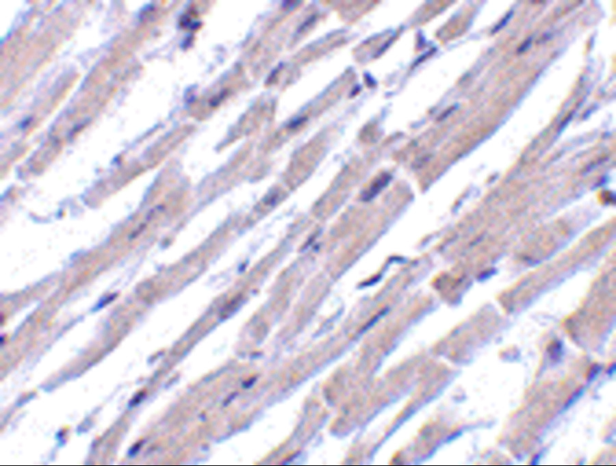 Immunohistochemistry of Bcl-rambo in human heart tissue with Bcl-rambo antibody at 10 μg/mL. Immunohistochemistry of Bcl-rambo in human heart tissue with Bcl-rambo antibody at 10 μg/mL.