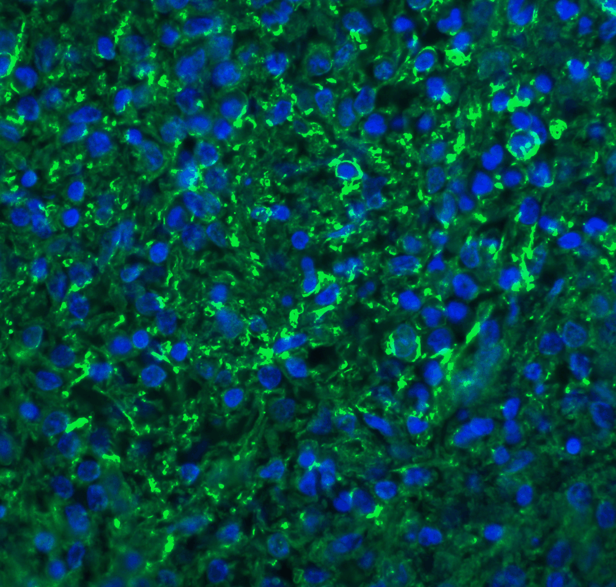 Immunofluorescence of Bonzo in human spleen tissue with Bonzo antibody at 20 μg/ml.<br><br>Green: Bonzo Antibody (2209) <br> Blue: DAPI staining