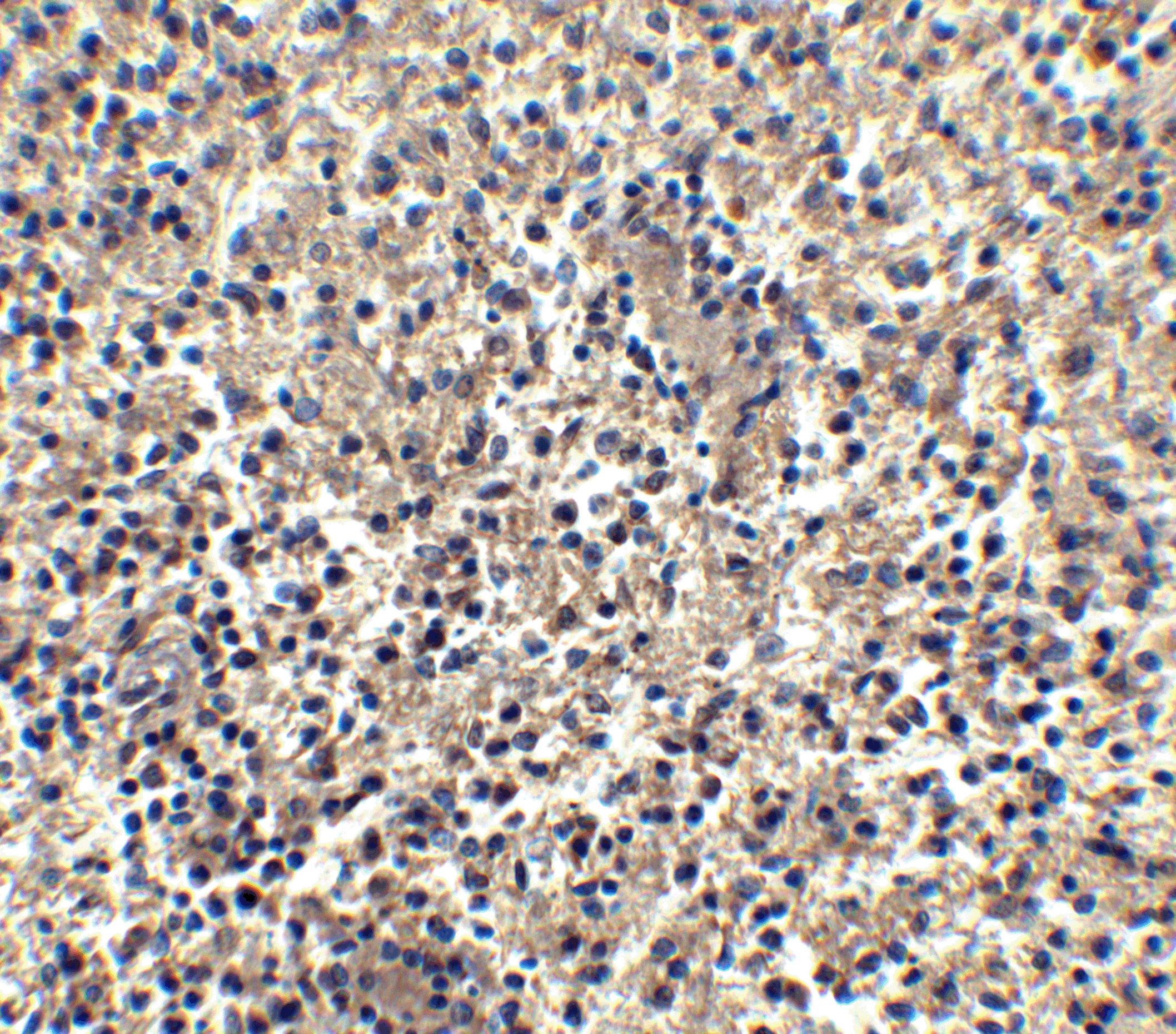 Immunohistochemistry of Bonzo in human spleen tissue with Bonzo antibody at 2.5 μg/ml.