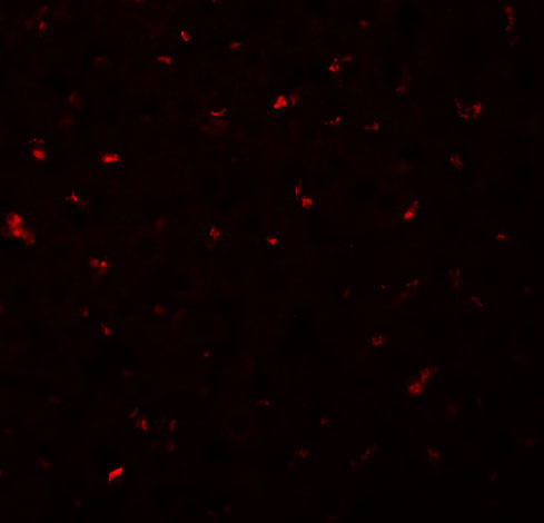 Immunofluorescence of CALHM1 in Rat Liver cells with CALHM1 antibody at 20 μg/mL. Immunofluorescence of CALHM1 in Rat Liver cells with CALHM1 antibody at 20 μg/mL.