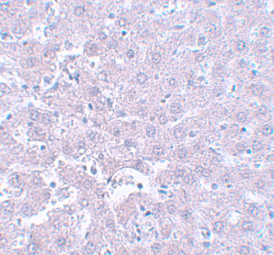 Immunohistochemistry of CALHM1 in rat liver tissue with CALHM1 antibody at 5 μg/mL. Immunohistochemistry of CALHM1 in rat liver tissue with CALHM1 antibody at 5 μg/mL.