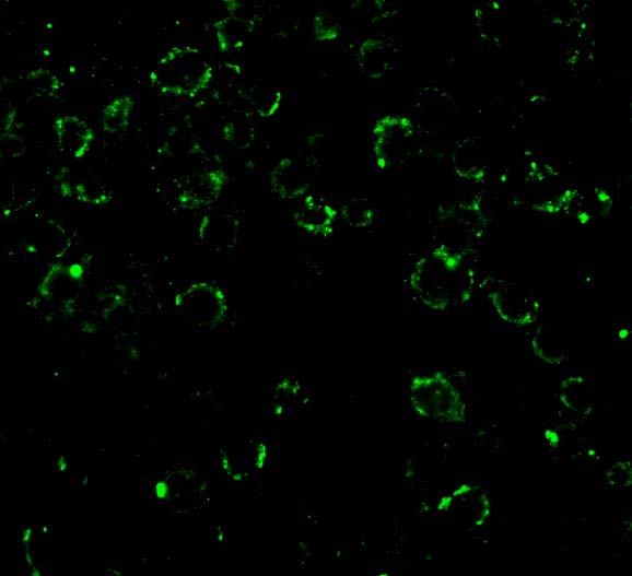 Immunofluorescence of CARD10 in EL4 cells with CARD10 antibody at 20 μg/mL. Immunofluorescence of CARD10 in EL4 cells with CARD10 antibody at 20 μg/mL.