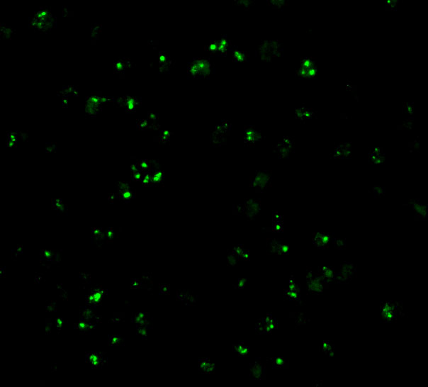 Immunofluorescence of CARD8 in K562 cells with CARD8 antibody at 20 μg/mL. Immunofluorescence of CARD8 in K562 cells with CARD8 antibody at 20 μg/mL.