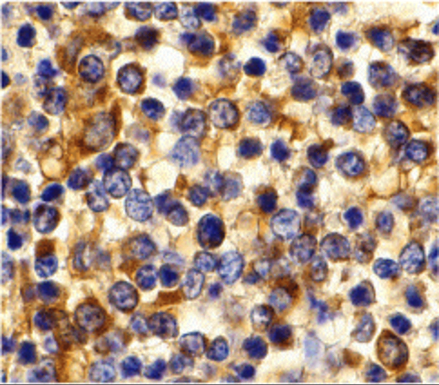 Immunohistochemistry of CCR3 in human spleen tissue with CCR3 antibody at 10 μg/mL. Immunohistochemistry of CCR3 in human spleen tissue with CCR3 antibody at 10 μg/mL.