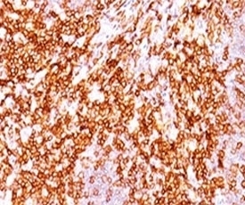 IHC testing of FFPE human tonsil and CD68 antibody (LAM34-1). IHC testing of FFPE human tonsil and CD68 antibody (LAM34-1).