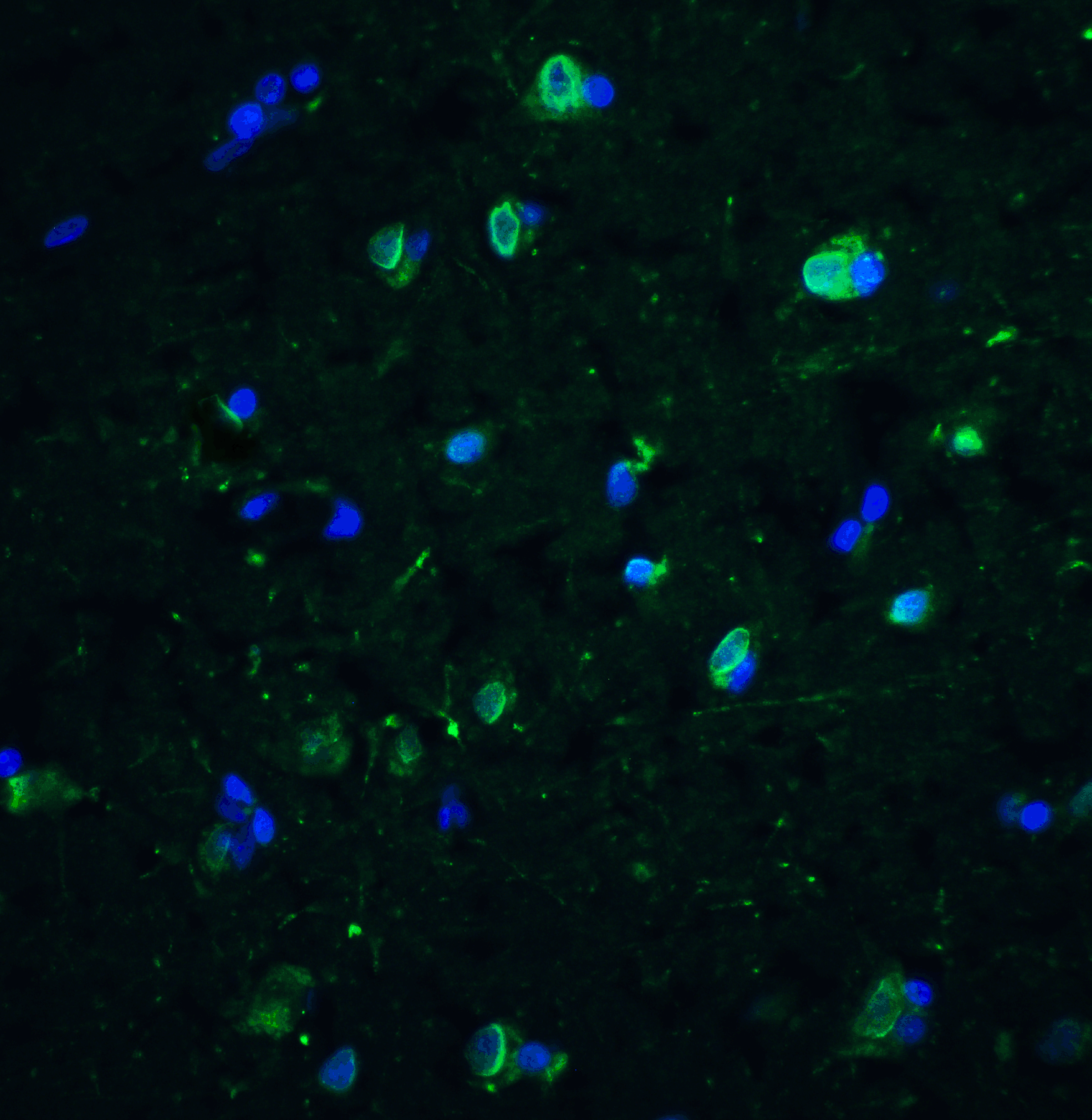 Immunofluorescence of CD81 in human brain tissue with CD81 antibody at 10 μg/ml.<br><br>Green: CD81 Antibody (5195) <br> Blue: DAPI staining Immunofluorescence of CD81 in human brain tissue with CD81 antibody at 10 μg/ml.<br><br>Green: CD81 Antibody (5195) <br> Blue: DAPI staining