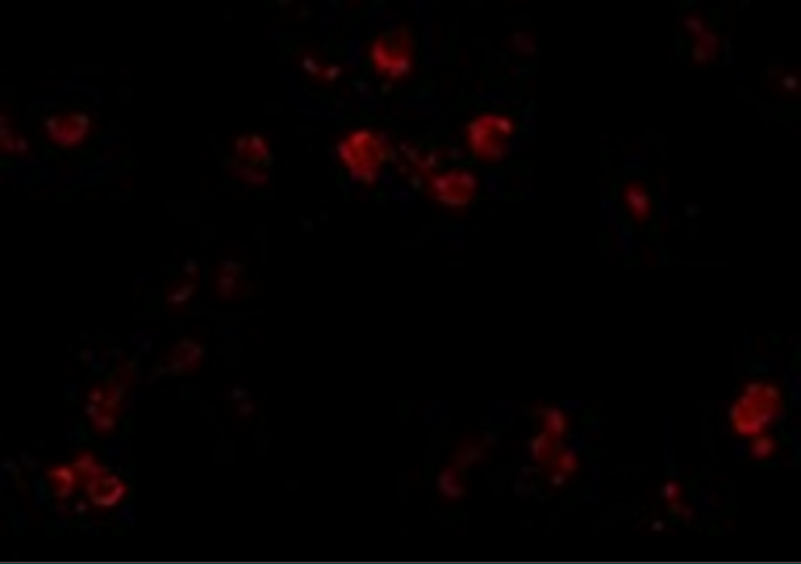 Immunofluorescence of CD81 in A549 cells with CD81 antibody at 20 μg/mL. Immunofluorescence of CD81 in A549 cells with CD81 antibody at 20 μg/mL.