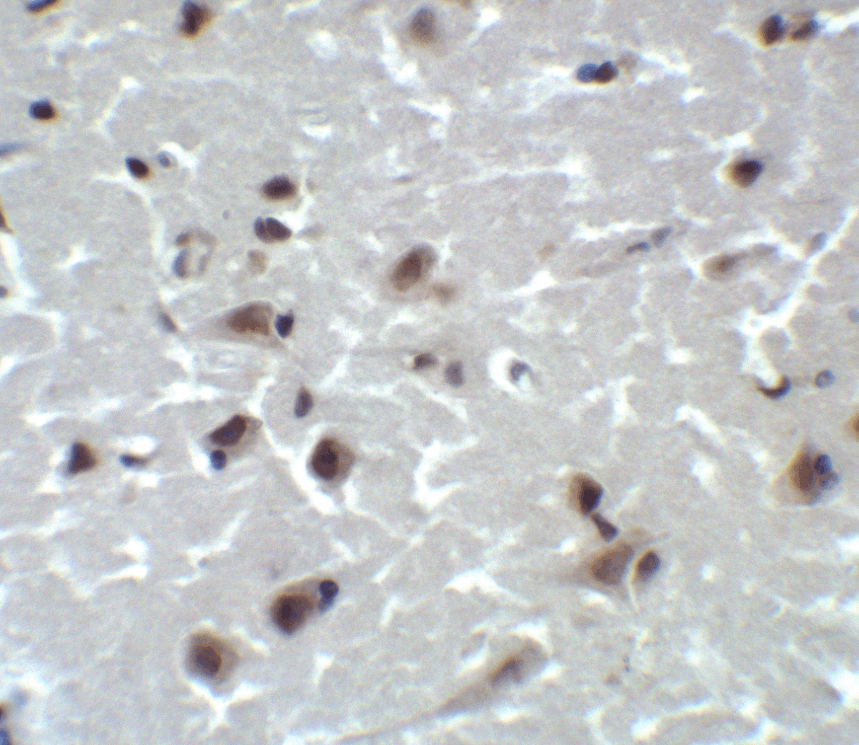 Immunohistochemistry of CD81 in human brain tissue with CD81 antibody at 2 μg/ml. Immunohistochemistry of CD81 in human brain tissue with CD81 antibody at 2 μg/ml.
