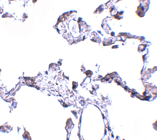 Immunohistochemistry of CD81 in human lung tissue with CD81 antibody at 5 μg/mL. Immunohistochemistry of CD81 in human lung tissue with CD81 antibody at 5 μg/mL.