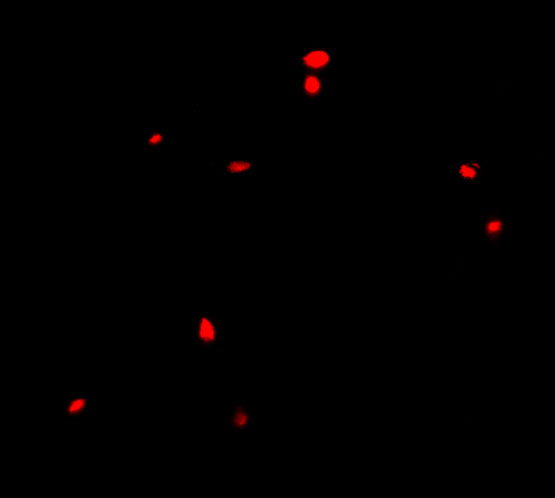 Immunofluorescence of CIDE-B in Human Small Intestine cells with CIDE-B antibody at 20 μg/mL. Immunofluorescence of CIDE-B in Human Small Intestine cells with CIDE-B antibody at 20 μg/mL.