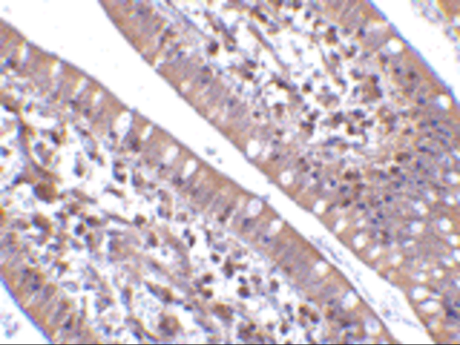 Immunohistochemistry of CIDE-B in human small intestine tissue with CIDE-B antibody at 5 μg/mL. Immunohistochemistry of CIDE-B in human small intestine tissue with CIDE-B antibody at 5 μg/mL.