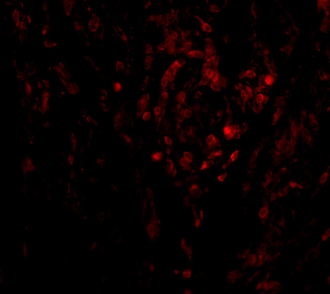 Immunofluorescence of CIKS in human lung tissue with CIKS antibody at 20 μg/mL. Immunofluorescence of CIKS in human lung tissue with CIKS antibody at 20 μg/mL.
