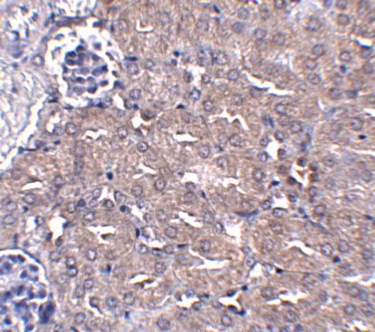 Immunohistochemistry of CIP75 in mouse kidney tissue with CIP75 antibody at 5 μg/mL. Immunohistochemistry of CIP75 in mouse kidney tissue with CIP75 antibody at 5 μg/mL.