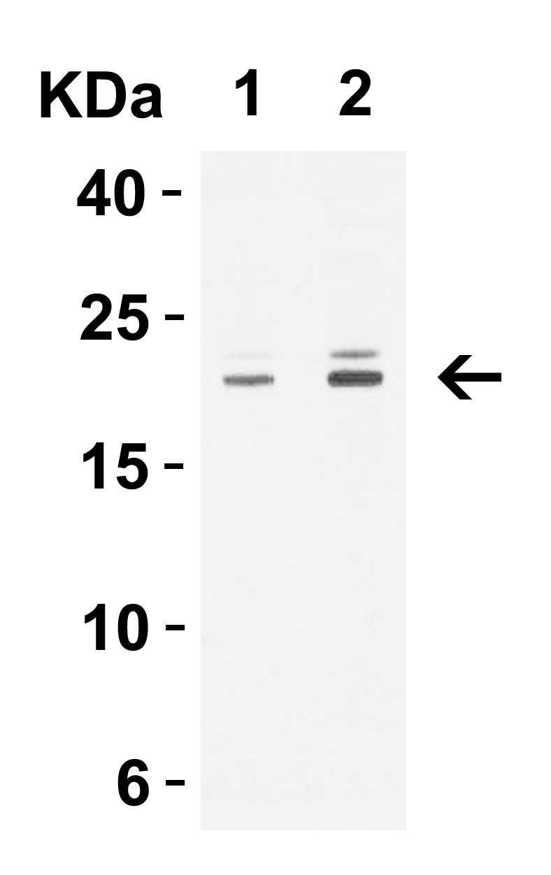 <strong>Figure 3 Western Blot Validation in Human Tissue Lysates</strong><br>
Loading: 15 μg of lysates per lane.
Antibodies: CLDN1, 5187 (1 μg/mL) , 1h incubation at RT in 5% NFDM/TBST.
Secondary: Goat anti-rabbit IgG HRP conjugate at 1:10000 dilution. <strong>Figure 3 Western Blot Validation in Human Tissue Lysates</strong><br>
Loading: 15 μg of lysates per lane.
Antibodies: CLDN1, 5187 (1 μg/mL) , 1h incubation at RT in 5% NFDM/TBST.
Secondary: Goat anti-rabbit IgG HRP conjugate at 1:10000 dilution.