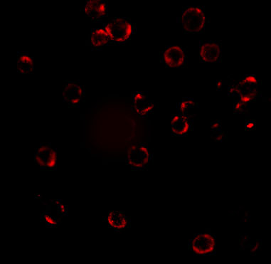 <strong>Figure 6 Immunofluorescence Validation of CXCR4 in HeLa Cells</strong><br> Immunofluorescent analysis of 4% paraformaldehyde-fixed HeLa cells labeling CXCR4 with 1009 at 20 μg/mL, followed by goat anti-rabbit IgG secondary antibody at 1/500 dilution (red). Image showing both membrane and cytoplasmic staining on HeLa cells. <strong>Figure 6 Immunofluorescence Validation of CXCR4 in HeLa Cells</strong><br> Immunofluorescent analysis of 4% paraformaldehyde-fixed HeLa cells labeling CXCR4 with 1009 at 20 μg/mL, followed by goat anti-rabbit IgG secondary antibody at 1/500 dilution (red). Image showing both membrane and cytoplasmic staining on HeLa cells.