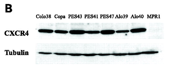<strong>Figure 12 WB Validation of CXCR4 in Human Metastatic Melanoma (Scala et al., 2006) </strong><br> CXCR4 protein was detected in the human metastatic melanoma cell lines and human melanoma cell line (colo38), but not in the human primary melanocytes (MPR1) with anti-CXCR4 antibodies. <strong>Figure 12 WB Validation of CXCR4 in Human Metastatic Melanoma (Scala et al., 2006) </strong><br> CXCR4 protein was detected in the human metastatic melanoma cell lines and human melanoma cell line (colo38), but not in the human primary melanocytes (MPR1) with anti-CXCR4 antibodies.