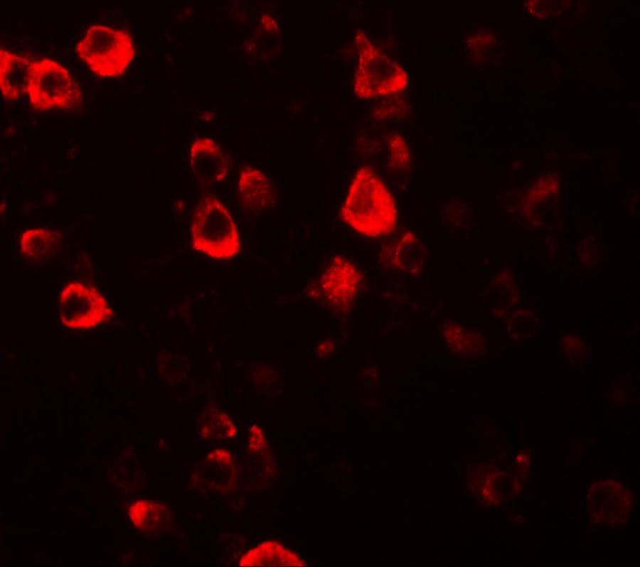 Immunofluorescence of CXXC4 in human brain tissue with CXXC4 antibody at 20 μg/mL. Immunofluorescence of CXXC4 in human brain tissue with CXXC4 antibody at 20 μg/mL.