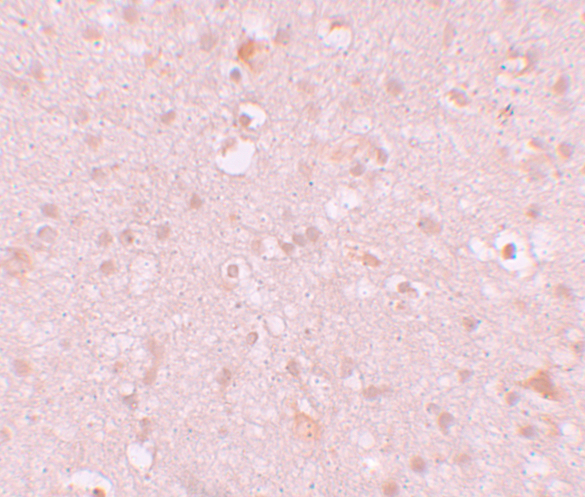 Immunohistochemistry of CXXC4 in human brain tissue with CXXC4 antibody at 10 μg/mL. Immunohistochemistry of CXXC4 in human brain tissue with CXXC4 antibody at 10 μg/mL.