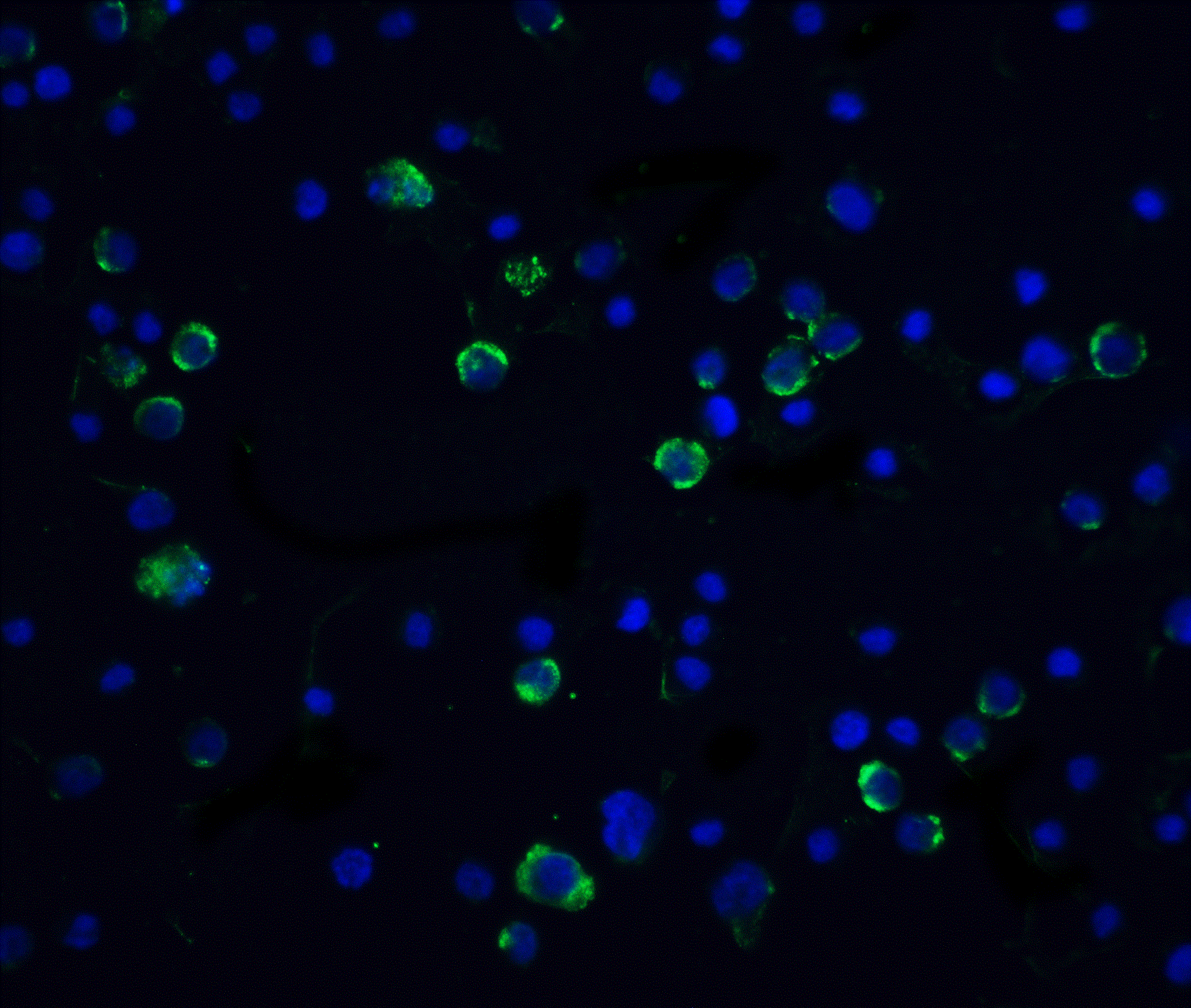 Immunofluorescence of Casp10 in Hela cells with Caspase 10 antibody at 20 μg/mL.<br><br>Green: Caspase-10 Antibody (1128) <br> Blue: DAPI staining Immunofluorescence of Casp10 in Hela cells with Caspase 10 antibody at 20 μg/mL.<br><br>Green: Caspase-10 Antibody (1128) <br> Blue: DAPI staining
