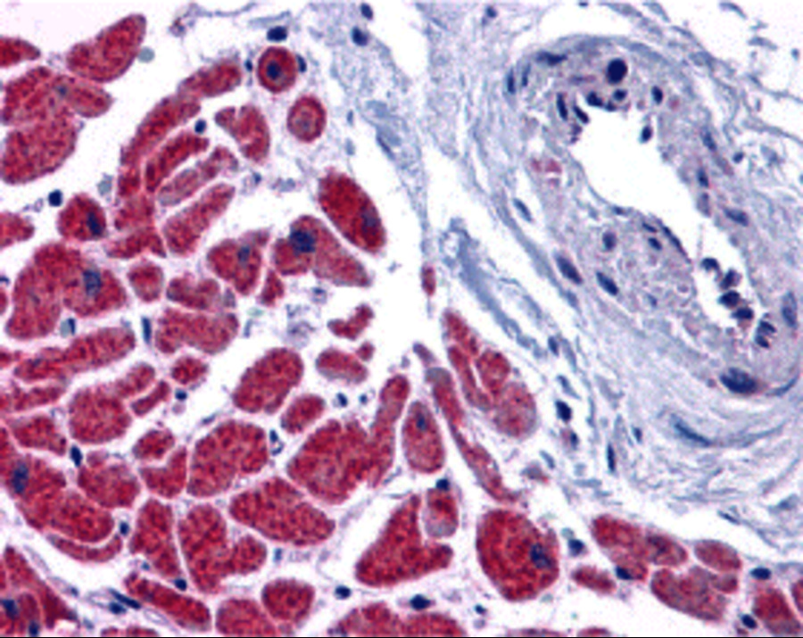 Immunohistochemistry of caspase-12 in human heart tissue with caspase-12 antibody at 10 μg/mL. Immunohistochemistry of caspase-12 in human heart tissue with caspase-12 antibody at 10 μg/mL.
