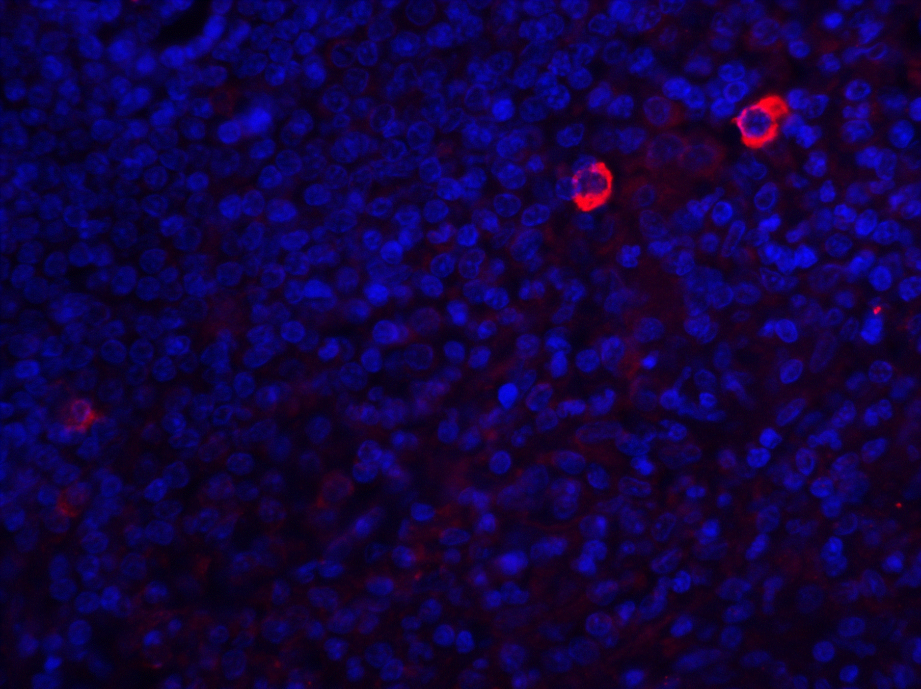Immunofluorescence of Caspase-8 in human spleen tissue with Caspase-8 antibody at 20 μg/ml.<br><br>Red: Caspase-8 Antibody (3473) <br> Blue: DAPI staining Immunofluorescence of Caspase-8 in human spleen tissue with Caspase-8 antibody at 20 μg/ml.<br><br>Red: Caspase-8 Antibody (3473) <br> Blue: DAPI staining