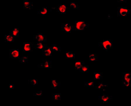 Immunofluorescence of Caspase-8 in Jurkat cells with Caspase-8 antibody at 20 μg/mL. Immunofluorescence of Caspase-8 in Jurkat cells with Caspase-8 antibody at 20 μg/mL.