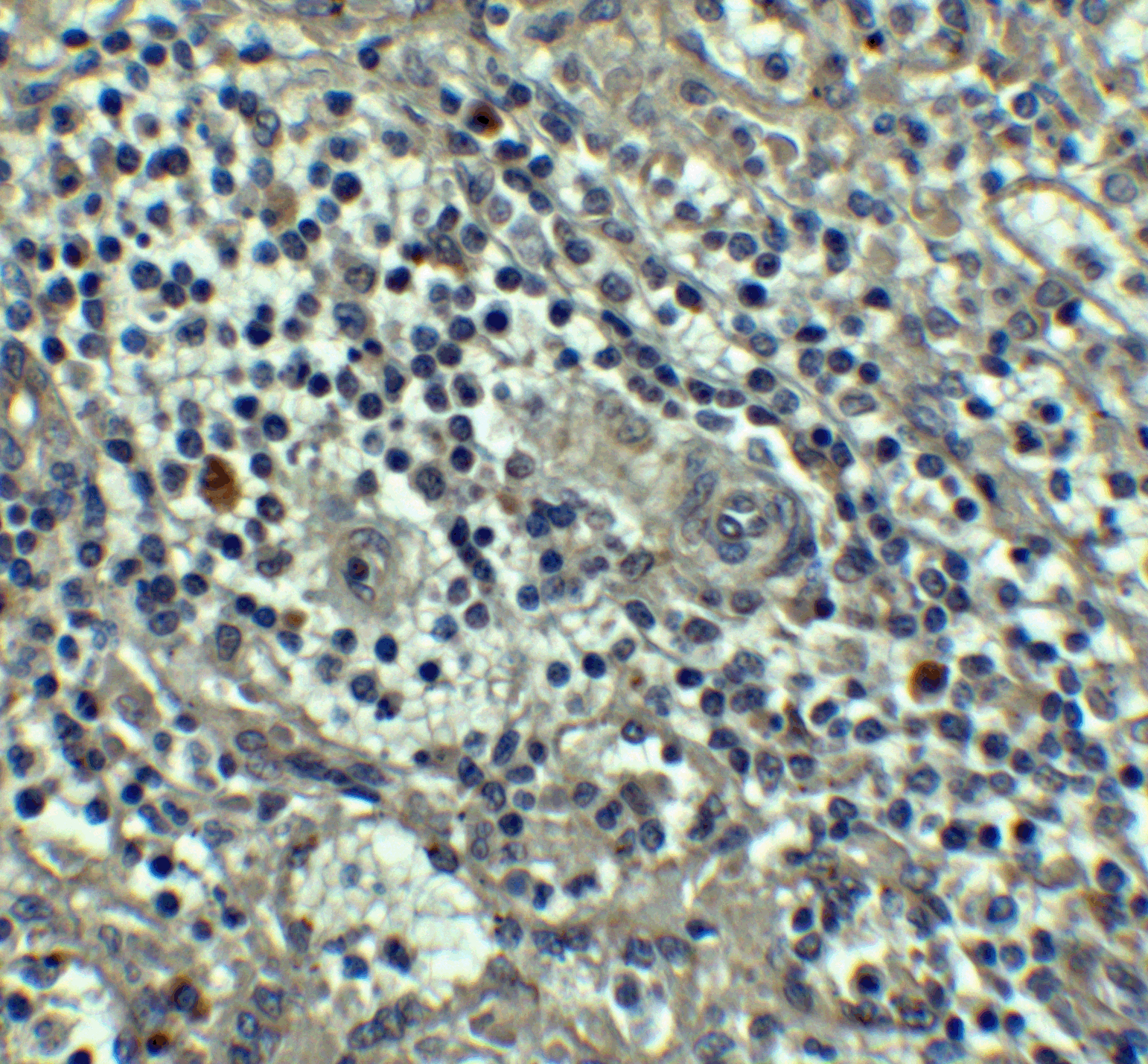 Immunohistochemistry of Caspase-8 in human spleen tissue with Caspase-8 antibody at 5 μg/mL. Immunohistochemistry of Caspase-8 in human spleen tissue with Caspase-8 antibody at 5 μg/mL.