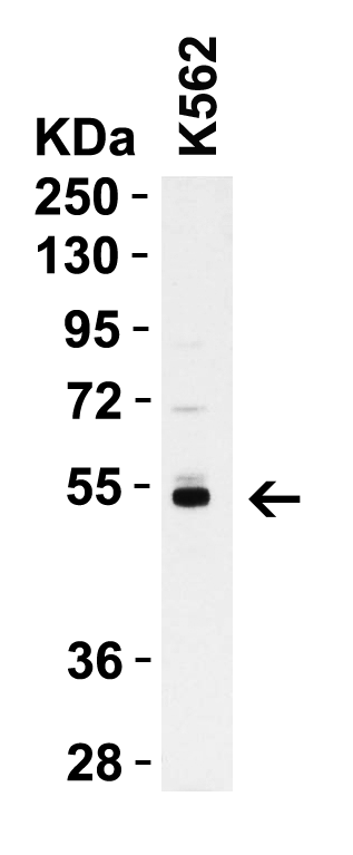 <strong>WB Validation in Human K562 Cells</strong><br>
Loading: 15 μg of K562 cell lysate
Antibodies: Casp8 3473, 1 μg/mL, 1 h incubation at RT in 5% NFDM/TBST.
Secondary: Goat Anti-Rabbit IgG HRP conjugate at 1:10000 dilution. <strong>WB Validation in Human K562 Cells</strong><br>
Loading: 15 μg of K562 cell lysate
Antibodies: Casp8 3473, 1 μg/mL, 1 h incubation at RT in 5% NFDM/TBST.
Secondary: Goat Anti-Rabbit IgG HRP conjugate at 1:10000 dilution.
