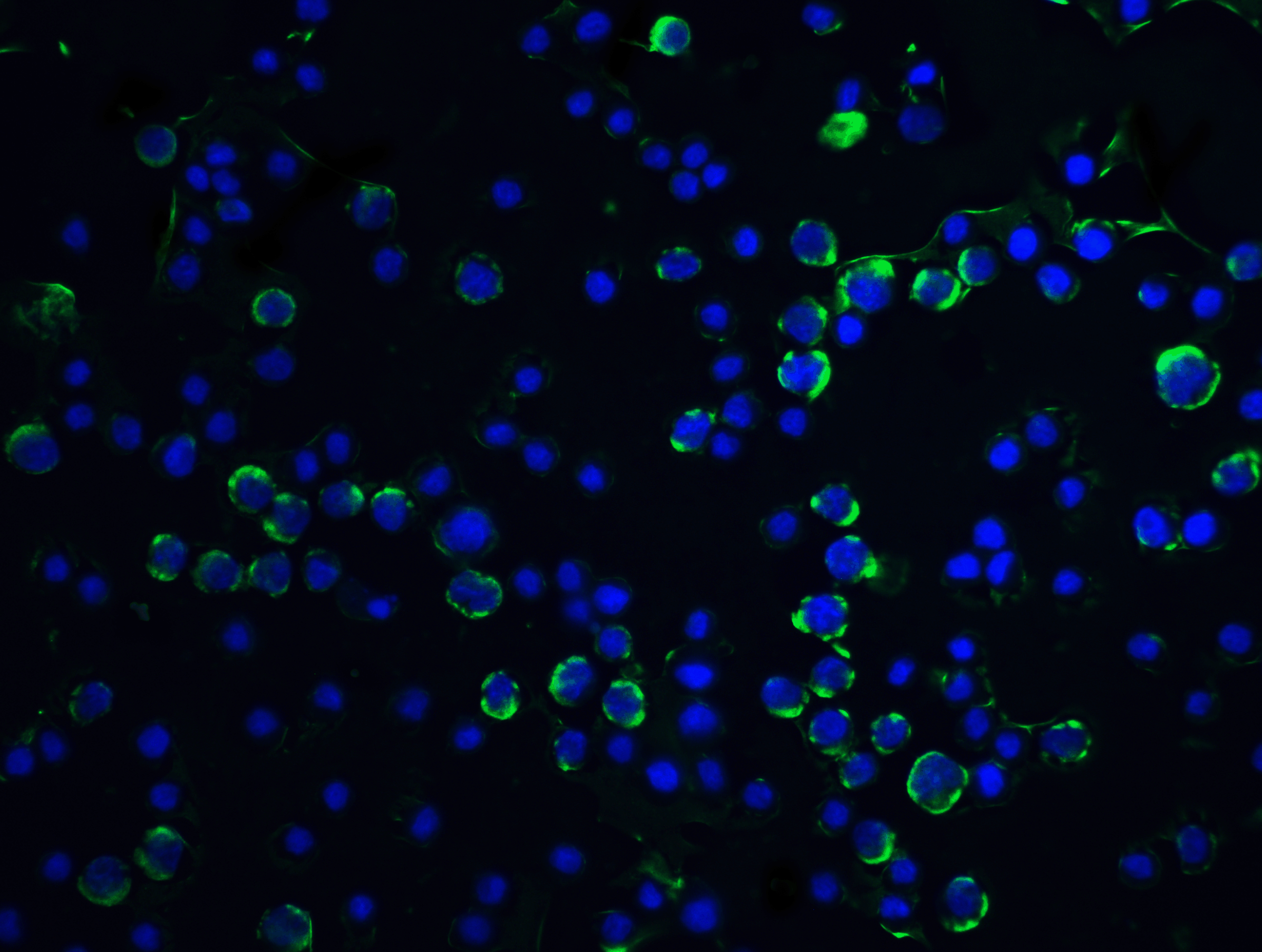 <strong>Figure 5 Immunofluorescence Validation of Caspase 9 in HeLa Cells</strong><br>
Immunofluorescent analysis of 4% paraformaldehyde-fixed HeLa cells labeling Caspase 9 with 2073 at 5 μg/mL, followed by goat anti-rabbit IgG secondary antibody at 1/500 dilution (green) and DAPI staining (blue). <strong>Figure 5 Immunofluorescence Validation of Caspase 9 in HeLa Cells</strong><br>
Immunofluorescent analysis of 4% paraformaldehyde-fixed HeLa cells labeling Caspase 9 with 2073 at 5 μg/mL, followed by goat anti-rabbit IgG secondary antibody at 1/500 dilution (green) and DAPI staining (blue).