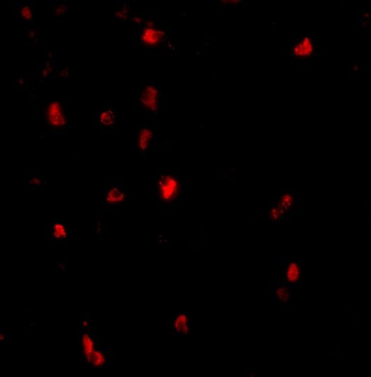 Immunofluorescence of cbl in human lymph node tissue with cbl antibody at 20 μg/mL.