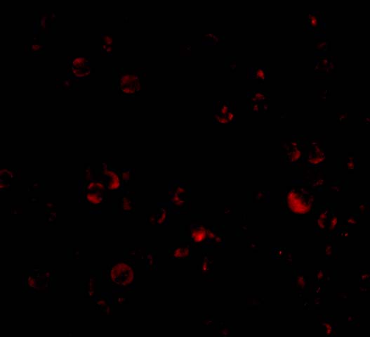 Immunofluorescence of DDX3 in HepG2 cells with DDX3 antibody at 20 μg/mL.