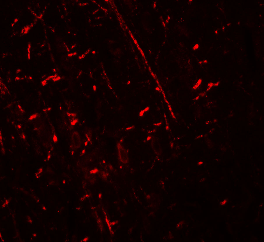 Immunofluorescence of DDX41 in rat brain tissue with DDX41 antibody at 20 μg/ml.