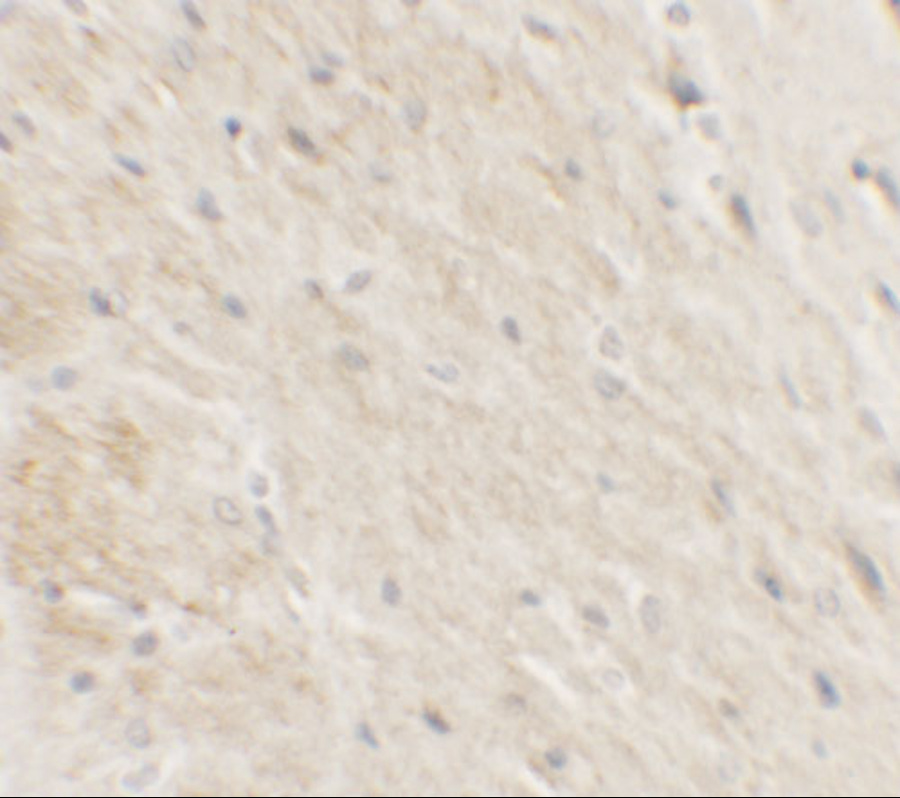 Immunohistochemistry of DDX41 in rat brain tissue with DDX41 antibody at 2.5 μg/ml.