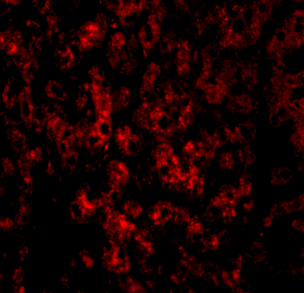 <strong>Figure 3 Immunofluorescence Validation of DRAM in Human Liver Tissue</strong><br>
Immunofluorescent analysis of 4% paraformaldehyde-fixed human liver tissue labeling DRAM with 4033 at 20 μg/mL, followed by goat anti-rabbit IgG secondary antibody at 1/500 dilution (red). <strong>Figure 3 Immunofluorescence Validation of DRAM in Human Liver Tissue</strong><br>
Immunofluorescent analysis of 4% paraformaldehyde-fixed human liver tissue labeling DRAM with 4033 at 20 μg/mL, followed by goat anti-rabbit IgG secondary antibody at 1/500 dilution (red).