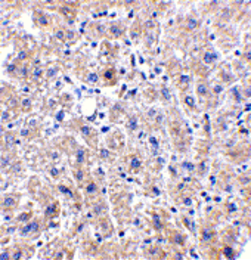<strong>Figure 4 Immunohistochemistry Validation of DRAM in Human Liver Tissue </strong><br>
Immunohistochemical analysis of paraffin-embedded human liver tissue using anti-DRAM antibody (4033) at 2.5 μg/ml. Tissue was fixed with formaldehyde and blocked with 10% serum for 1 h at RT; antigen retrieval was by heat mediation with a citrate buffer (pH6). Samples were incubated with primary antibody overnight at 4˚C. A goat anti-rabbit IgG H&L (HRP) at 1/250 was used as secondary. Counter stained with Hematoxylin. <strong>Figure 4 Immunohistochemistry Validation of DRAM in Human Liver Tissue </strong><br>
Immunohistochemical analysis of paraffin-embedded human liver tissue using anti-DRAM antibody (4033) at 2.5 μg/ml. Tissue was fixed with formaldehyde and blocked with 10% serum for 1 h at RT; antigen retrieval was by heat mediation with a citrate buffer (pH6). Samples were incubated with primary antibody overnight at 4˚C. A goat anti-rabbit IgG H&L (HRP) at 1/250 was used as secondary. Counter stained with Hematoxylin.