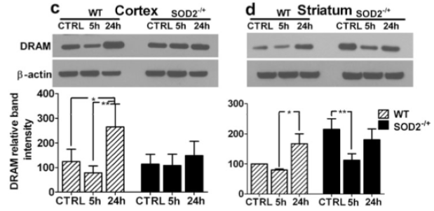 <strong>Figure 6 Regulated Expression Validation of DRAM in Heterozygous SOD2 KO Mice (Mehta et al., 2011) </strong><br>
DRAM expression level detected by anti-DRAM antibodies (4033) decreased in striatum of SOD <sup>-/+ </sup> KO mice (fig. d) as compared to WT mice . <strong>Figure 6 Regulated Expression Validation of DRAM in Heterozygous SOD2 KO Mice (Mehta et al., 2011) </strong><br>
DRAM expression level detected by anti-DRAM antibodies (4033) decreased in striatum of SOD <sup>-/+ </sup> KO mice (fig. d) as compared to WT mice .