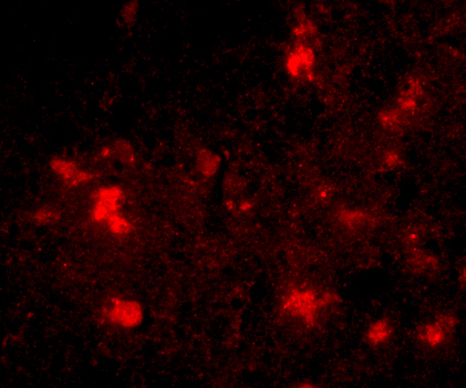 Immunofluorescence of Dact2 in Human Brain cells with Dact2 antibody at 20 μg/mL. Immunofluorescence of Dact2 in Human Brain cells with Dact2 antibody at 20 μg/mL.