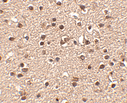 Immunohistochemistry of Dact2 in human brain tissue with Dact2 antibody at 2.5 μg/mL. Immunohistochemistry of Dact2 in human brain tissue with Dact2 antibody at 2.5 μg/mL.