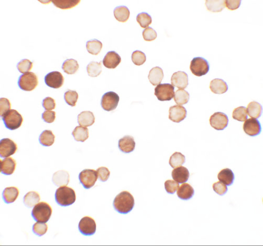 Immunocytochemistry of ERRF in HeLa cells with ERRF antibody at 2.5 μg/ml. Immunocytochemistry of ERRF in HeLa cells with ERRF antibody at 2.5 μg/ml.