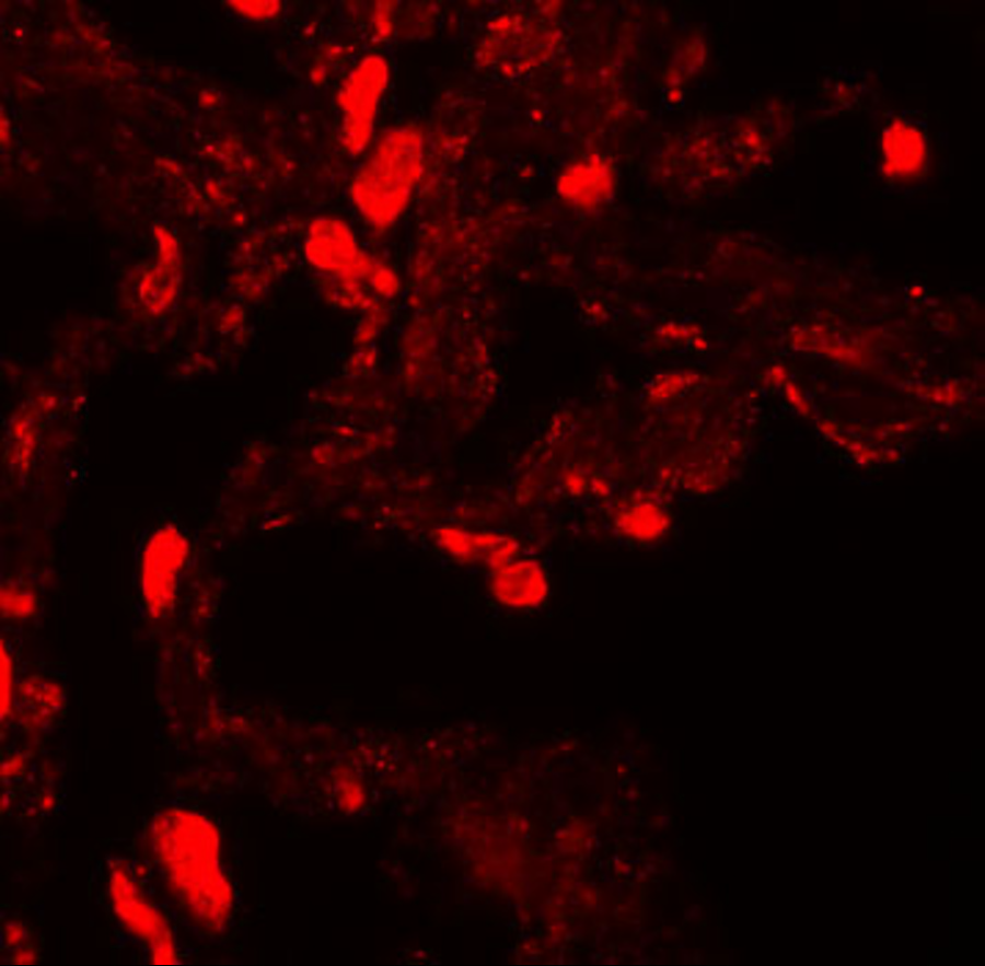 Immunofluorescence of EZH1 in human lung tissue with EZH1 antibody at 20 μg/mL. Immunofluorescence of EZH1 in human lung tissue with EZH1 antibody at 20 μg/mL.