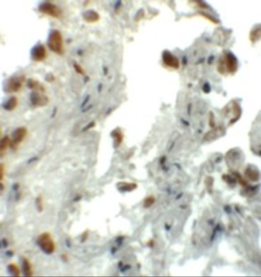 Immunohistochemistry of EZH1 in human lung tissue with EZH1 antibody at 5 μg/mL. Immunohistochemistry of EZH1 in human lung tissue with EZH1 antibody at 5 μg/mL.
