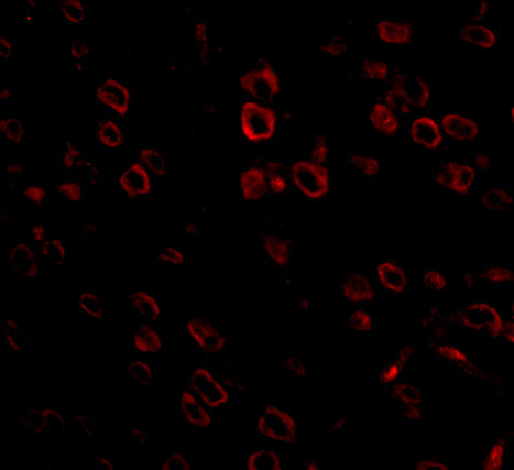 Immunofluorescence of FKBP15 in mouse brain tissue with FKBP15 antibody at 20 μg/mL. Immunofluorescence of FKBP15 in mouse brain tissue with FKBP15 antibody at 20 μg/mL.