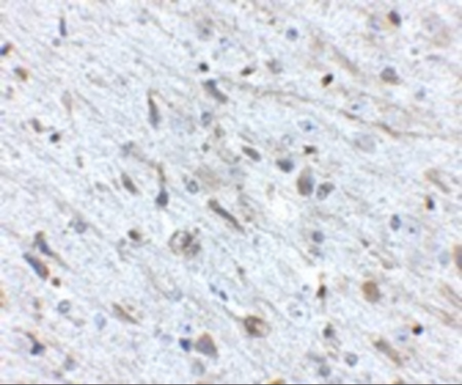 Immunohistochemistry of FKBP15 in mouse brain tissue with FKBP15 antibody at 2.5 μg/mL. Immunohistochemistry of FKBP15 in mouse brain tissue with FKBP15 antibody at 2.5 μg/mL.
