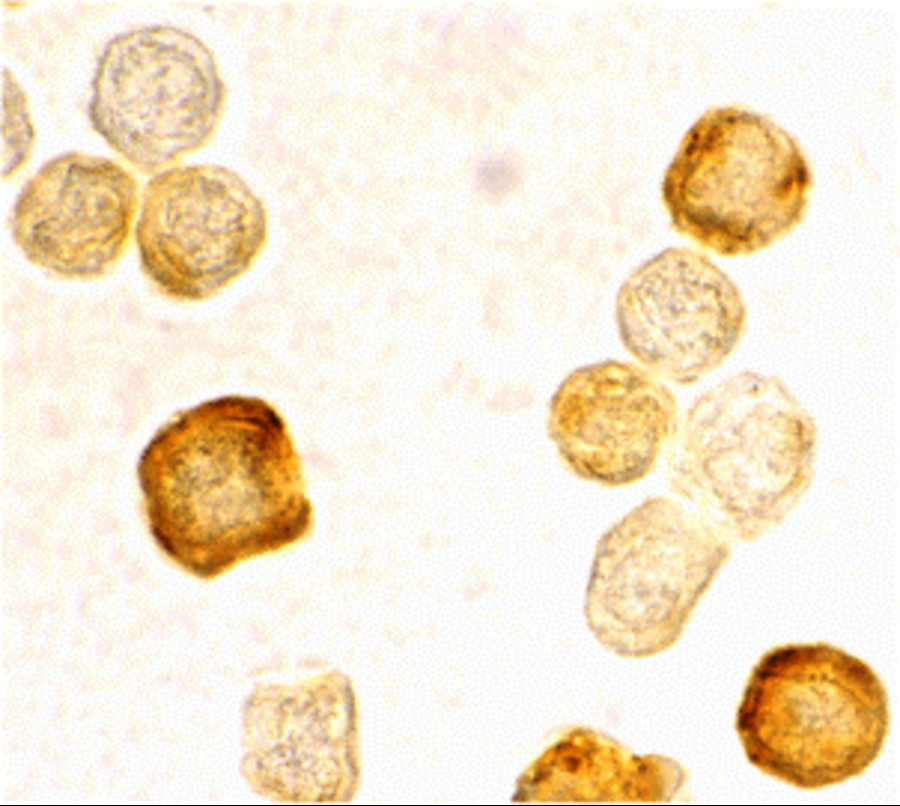 Immunocytochemistry staining of HeLa cells using FLIP antibody at 2 μg/mL. Immunocytochemistry staining of HeLa cells using FLIP antibody at 2 μg/mL.