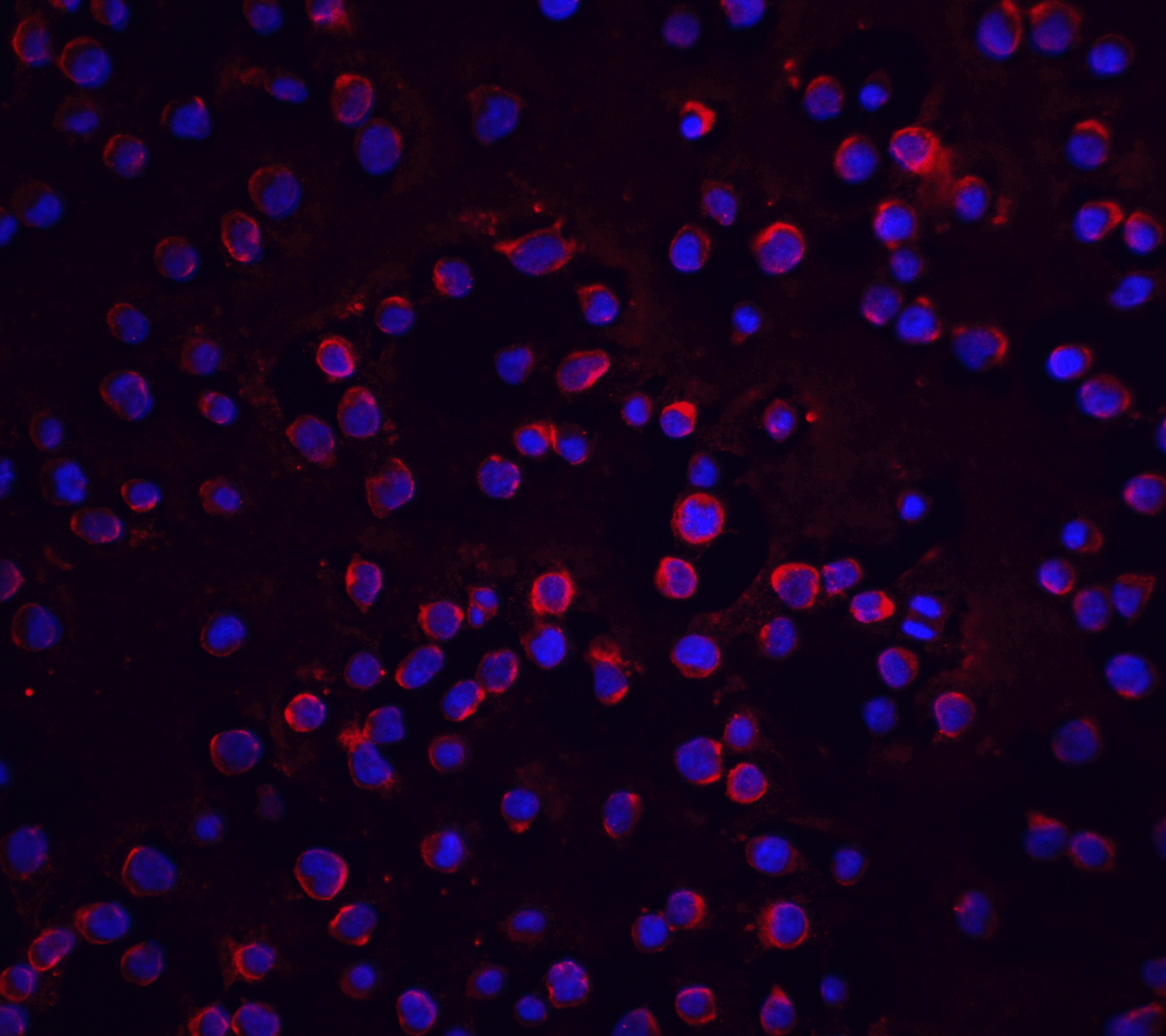 Immunofluorescence of FLIP in Jurkat cells with FLIP antibody at 20 μg/mL.<br><br>Red: FLIP Antibody (2055) <br> Blue: DAPI staining Immunofluorescence of FLIP in Jurkat cells with FLIP antibody at 20 μg/mL.<br><br>Red: FLIP Antibody (2055) <br> Blue: DAPI staining