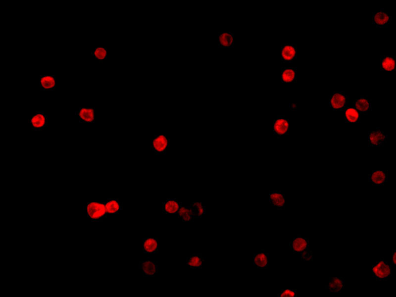 Immunofluorescence of FLIP in HeLa cells with FLIP antibody at 10 μg/mL. Immunofluorescence of FLIP in HeLa cells with FLIP antibody at 10 μg/mL.